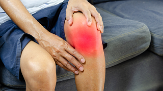 Gonartrosis de rodilla